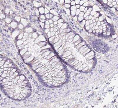 Immunohistochemistry-Paraffin: Surfactant Protein A Antibody [NBP2-46679]