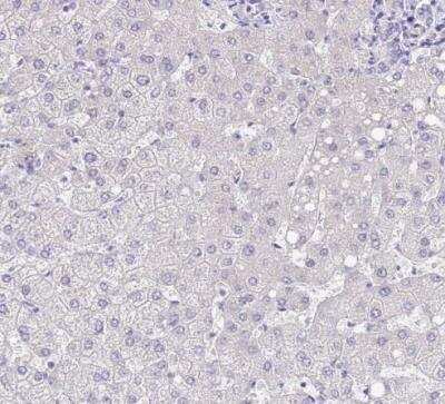 Immunohistochemistry-Paraffin: Surfactant Protein A Antibody [NBP2-46679]