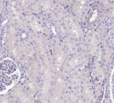Immunohistochemistry-Paraffin: Surfactant Protein A Antibody [NBP2-46679]
