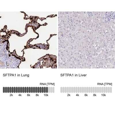 Immunohistochemistry-Paraffin: Surfactant Protein A Antibody [NBP2-46679]