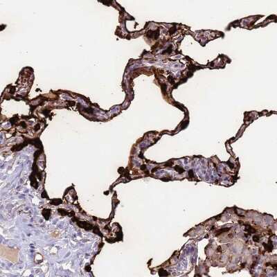 Immunohistochemistry-Paraffin: Surfactant Protein A Antibody [NBP2-46679]