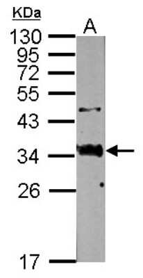 Western Blot: Surfactant Protein A Antibody [NBP2-15130]