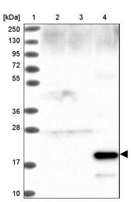 Western Blot: Surfactant Protein A Antibody [NBP2-46679]