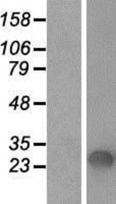 Western Blot: Surfactant Protein A Overexpression Lysate [NBP2-10468]