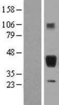 Western Blot: SP-B/Surfactant Protein B Overexpression Lysate [NBL1-15894]