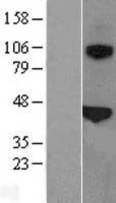 Western Blot: SP-B/Surfactant Protein B Overexpression Lysate [NBL1-15895]