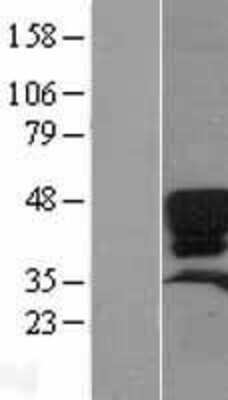 Western Blot: SP-D Overexpression Lysate [NBL1-15897]