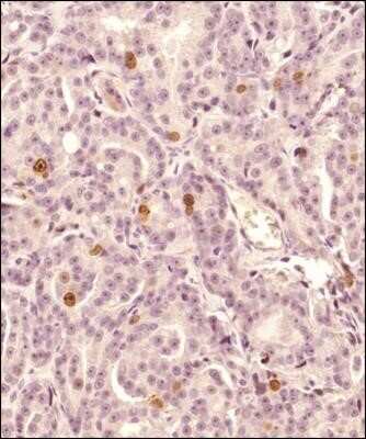 Immunohistochemistry-Paraffin: Survivin Antibody (1277A) - Azide and BSA Free [NBP2-80971]