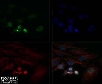Immunocytochemistry/ Immunofluorescence: Survivin Antibody (1277A) - BSA Free [NBP2-59503]