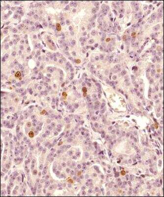 Immunohistochemistry-Paraffin: Survivin Antibody (1277A) - BSA Free [NBP2-59503]