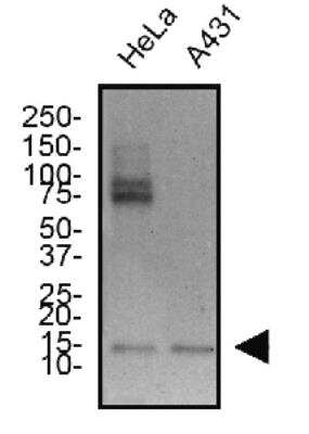 Western Blot: Survivin Antibody (1277A)BSA Free [NBP2-59503]