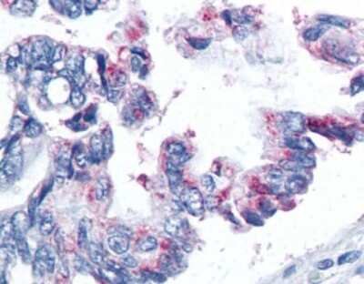Immunohistochemistry-Paraffin: Survivin Antibody (32.1) - BSA Free [NB500-237]