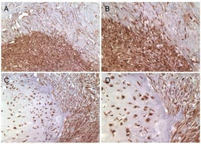 Immunohistochemistry: Survivin Antibody (60.11) - BSA Free [NB500-238]