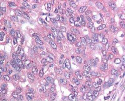 Immunohistochemistry-Paraffin: Survivin Antibody (60.11) - Unpurified [NB500-205]