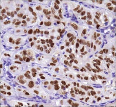 Immunohistochemistry: Survivin Antibody (8E2) [NB500-644]