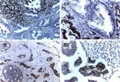 Immunohistochemistry: Survivin Antibody [NB100-56167]