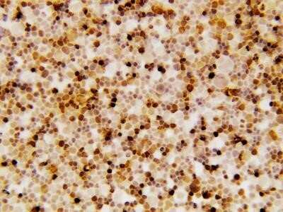 Immunohistochemistry: Survivin Antibody - BSA Free [NB500-201]