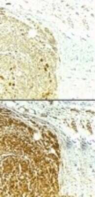 Immunohistochemistry: Survivin Antibody - BSA Free [NB500-201]