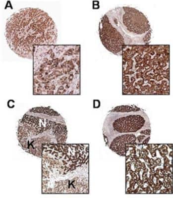 Immunohistochemistry: Survivin Antibody - BSA Free [NB500-201]