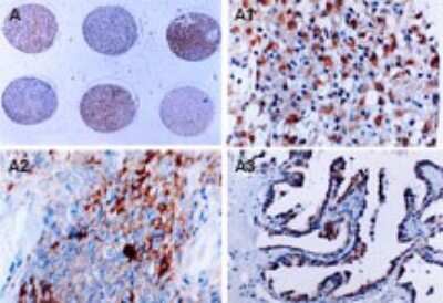 Immunohistochemistry-Paraffin: Survivin Antibody [NB100-56167]