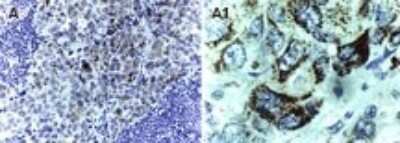 Immunohistochemistry-Paraffin: Survivin Antibody [NB100-56168]