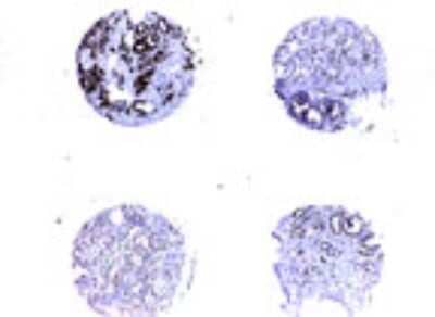 Immunohistochemistry-Paraffin: Survivin Antibody [NB100-56168]