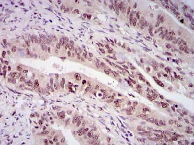 Immunohistochemistry-Paraffin: Survivin Antibody - BSA Free [NB500-201]