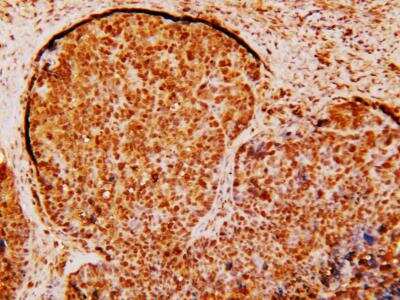 Immunohistochemistry-Paraffin: Survivin Antibody - BSA Free [NB500-201]