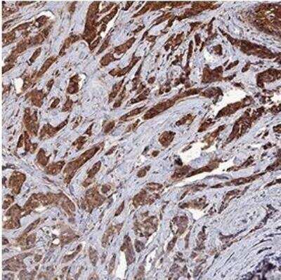 Immunohistochemistry-Paraffin: Survivin Antibody - BSA Free [NB500-201]