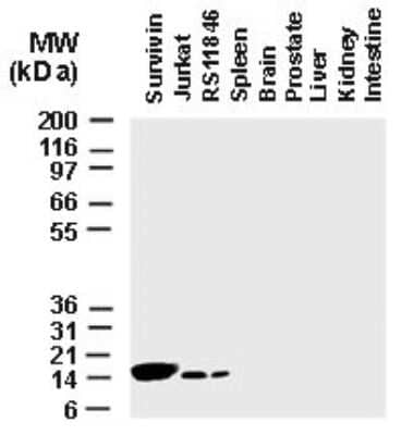 Western Blot: Survivin Antibody [NB100-56167]