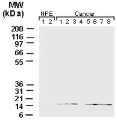 Western Blot: Survivin Antibody [NB100-56168]