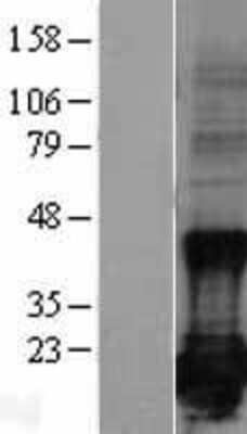 Western Blot: Survivin Overexpression Lysate [NBL1-07987]