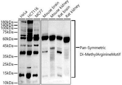 Western Blot: Symmetric Dimethyl Arginine Motif Antibody (5I1F7) [NBP3-16078]