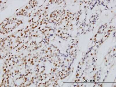 Immunohistochemistry-Paraffin: Symplekin Antibody (4C2) [H00008189-M03]