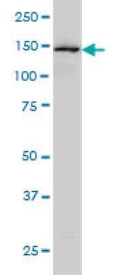Western Blot: Symplekin Antibody (4C2) [H00008189-M03]