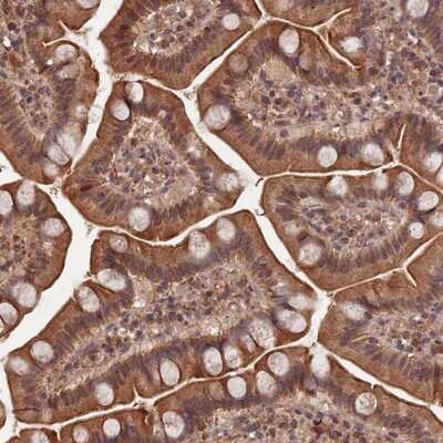 Immunohistochemistry-Paraffin: Symplekin Antibody [NBP1-92464]