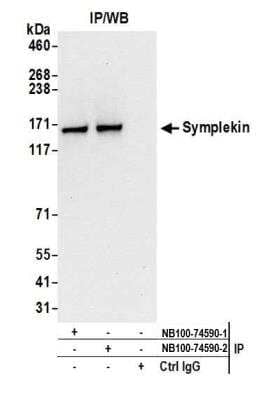 Immunoprecipitation: Symplekin Antibody [NB100-74590]