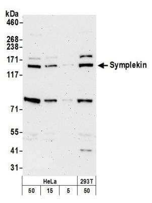 Western Blot: Symplekin Antibody [NB100-74591]