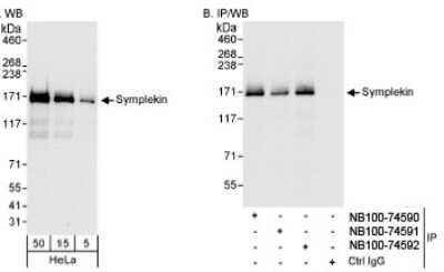 Western Blot: Symplekin Antibody [NB100-74592]