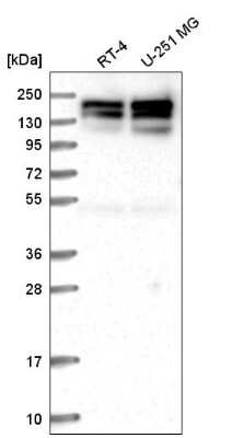 Western Blot: Symplekin Antibody [NBP2-59014]