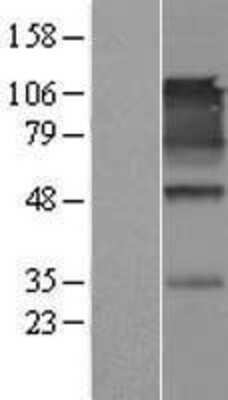 Western Blot: IGSF4A/SynCAM1/CADM1 Overexpression Lysate [NBL1-08638]