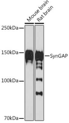 Western Blot: SynGAP Antibody (8M2S9) [NBP3-15787]