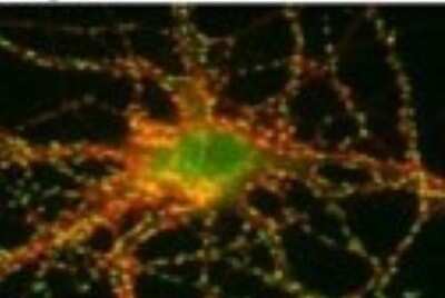 Immunocytochemistry/ Immunofluorescence: SynGAP Antibody [NB120-3344]