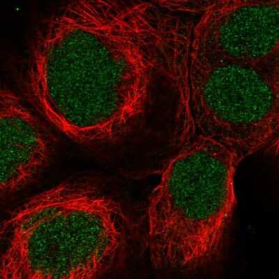 Immunocytochemistry/ Immunofluorescence: SynGAP Antibody [NBP1-87841]