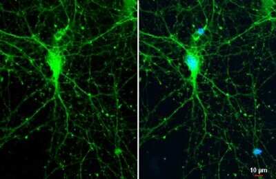 Immunocytochemistry/ Immunofluorescence: SynGAP Antibody [NBP3-13035]