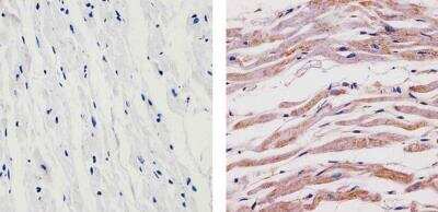 Immunohistochemistry-Paraffin: SynGAP Antibody [NB120-3344]