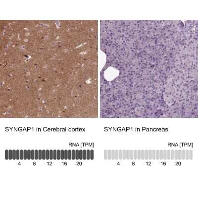 Immunohistochemistry-Paraffin: SynGAP Antibody [NBP1-87841]