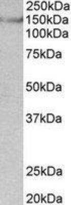 Western Blot: SynGAP Antibody [NBP2-27541]