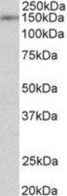 Western Blot: SynGAP Antibody [NBP2-27558]