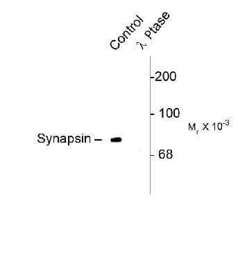 Western Blot: Synapsin I [p Ser549] Antibody [NB300-744]